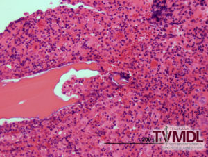 histopalogia de osso com ostepmielite