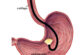 Abordagens em cavidade abdominal: celiotomia e endoscopia