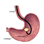 Abordagens em cavidade abdominal: celiotomia e endoscopia