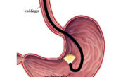 Abordagens em cavidade abdominal: celiotomia e endoscopia